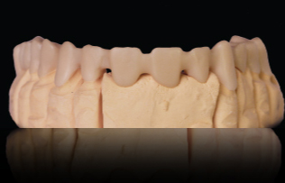 Zirconia Crown & Bridge